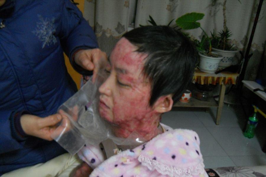 [讨论]拒爱遭毁容少女周岩