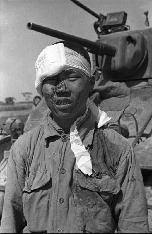 实拍1949年国军伤兵:满脸血污 躺在担架奄奄一息