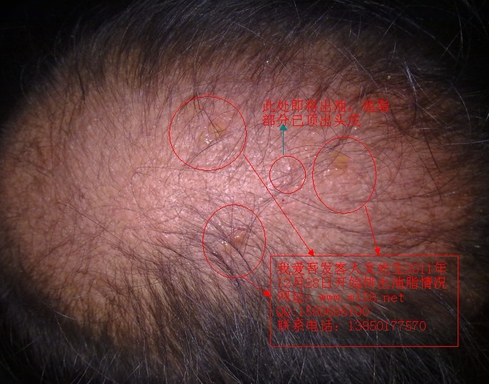 [原创]<em>为什么头发</em>油<em>的人</em>单洗护效果不好,<em>头发</em>还