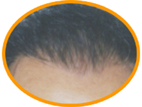 男生<em>头发</em>减笔画<em>图片</em>大全_男生<em>头发</em>减笔画<em>图片</em>